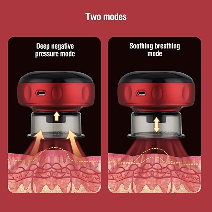 Intelligent Breathing Cupping Massage Instrument
